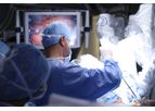 Imaging Systems for Robotic Surgery