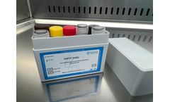 Acute Hepatopancreatic Necrosis Disease Detection Kits