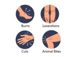 Wound Care Nurse Teaching:DOs and DON'Ts for Wounds Healing