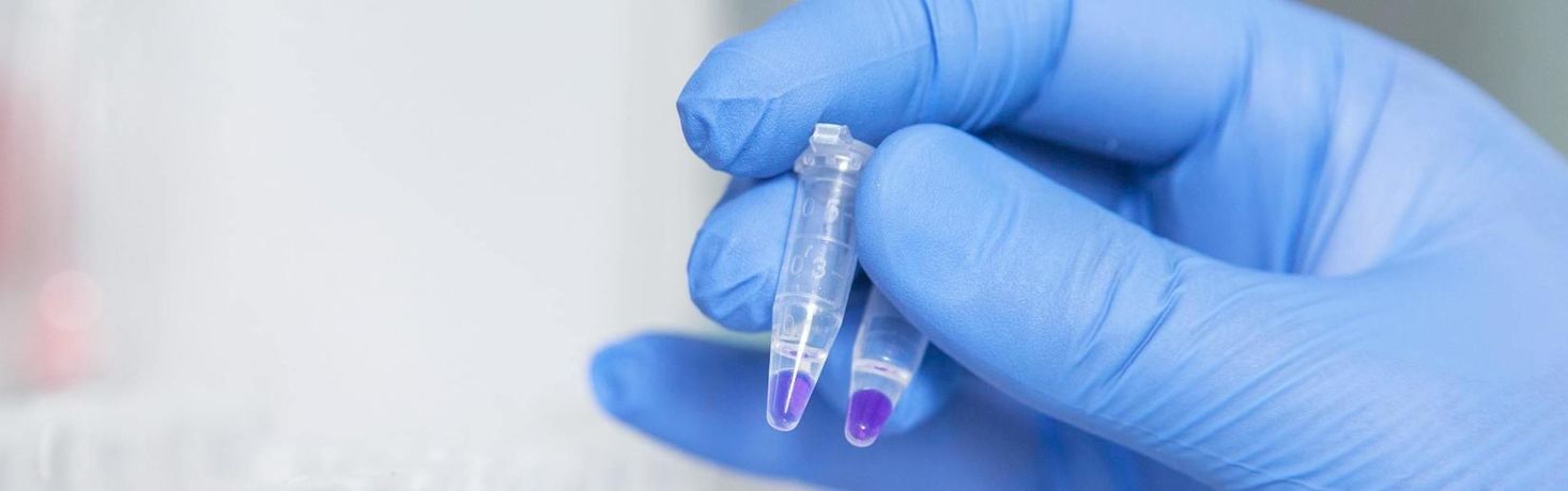 PCR Diagnostic