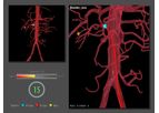 Endovascular Basic Skills Module