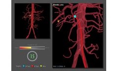 Endovascular Basic Skills Module