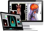 OsiriX MD - Medical Imaging Viewer Software