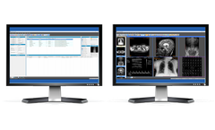 Santesoft - Sante PACS Server - Medical Image Management Solution