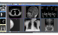 Santesof - Sante DICOM Editor - Medical Image Management Software