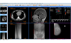 Sante - Sante DICOM Viewer for Mac