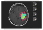 Graylight Imaging - AI-Powered Medical Image Analysis Systems