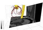 Cardiovascular Imaging And Ai-Enabled Cardiac Image Processing