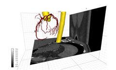 Cardiovascular Imaging And Ai-Enabled Cardiac Image Processing