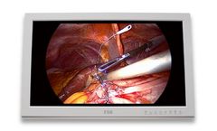 Double Black Imaging - Model C26SF-1 - 26-inch Surgical Operating Room Display