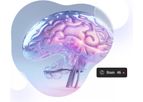 TruDiagnostic - Model SYMPHONYAge - Comprehensive Aging Analysis Tool