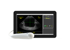 SeeMore - Model ViewBladder10 - Bladder Scanner Tablet