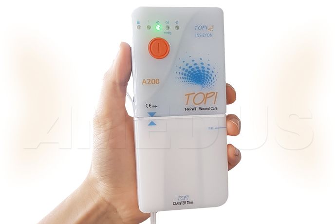 TopiVac - Model A200 - Mobile Disposable Vacuum Assisted Wound Care Therapy Device