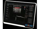 OncuraPartners - Model uSmart 3200t Vet - Oncura Terason Plus Veterinary Ultrasound System