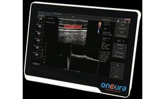 OncuraPartners - Model uSmart 3200t Vet - Oncura Terason Plus Veterinary Ultrasound System