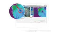 WoundVision - Wound Imaging and Documentation Solutions