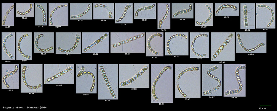 Flowcam For Aquatic - Shellfish Hatcheries And Fish Farming ...