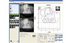 FilmQA - Pro 3.0 Software For Radiotherapy Plan Verification