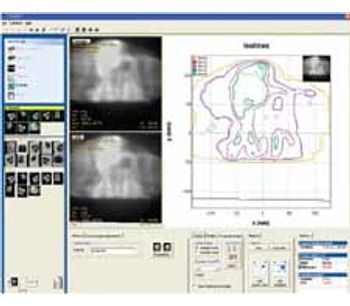 FilmQA - Pro 3.0 Software For Radiotherapy Plan Verification
