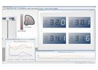 Envista - Model RTM - Refrigerators Temperature Manager System
