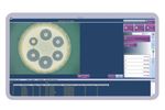 Synbiosis - Version eAST - Easy Antibiotic Susceptibility Testing Software