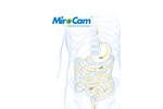 MiroCam - Capsule Endoscope Brochure