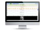 NOTOCORD-hem - Software Platform for Acquisition, Display and Analysis