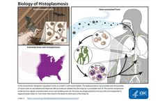 Histoplasmosis and Histoplasma capsulatum Exposure Risks Discussed in New Online Video