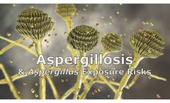 Aspergillosis and Aspergillus Exposure Risks Discussed in New Online Video