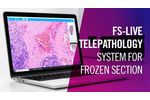 FS-Live Telepathology System for Frozen Section | by Motic Europe - Video