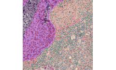 PathAI - Version PathExplore - Automated Tissue and Cell Detection Software
