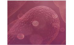 Endotoxins - LPS Endotoxicity Modulator
