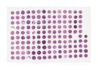 TriStar - Model TA3125 - IO Multi Tumor Array 2 of a set of 6 TMAs : Prostate ADC, HRPC/CRPC, Endometrial, Ovarian, Cervical, RCC with histopath data