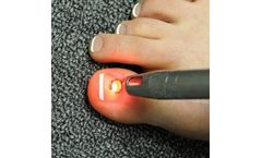Mobile Nail Laser Service