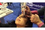 Watch: Tonometry THROUGH Eyelid & Sclera with DIATON tonometer - How to Use Tonometer - Video