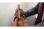 DIATON Tonometer Pen How to Measure Intraocular Eye Pressure IOP Through Eyelid Demo Goldmann Pascal - Video