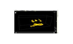 ACS - Version MIRA NEO - Application Desktop Software