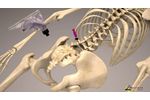 OmniBone Bone Marrow Biopsy Power - Video