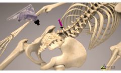 OmniBone Bone Marrow Biopsy Power - Video