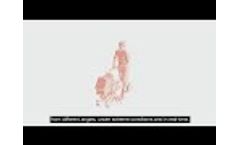 DILAX SLS-1000: Explanatory Film - Video