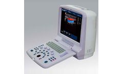 Landytop - Model 5000P - Portable Color Doppler Ultrasound Scanner