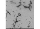 Alpha Synuclein Protein