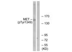 Model pTyr1349 - Anti-c-Met Antibody