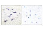 Model pSer2448 - Anti-mTOR Antibody