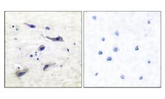 Model pSer2448 - Anti-mTOR Antibody