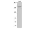 Model pTyr877 - Anti-HER2 Antibody