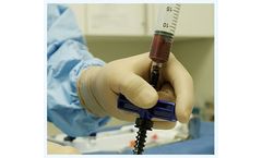 MdBiologix - Model Marrow Cellutions - Bone Graft Kits