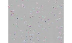 ParticleTech - Fermentation Analyzer