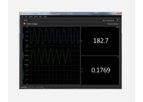 Real-Time Respiratory Monitoring