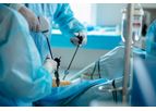Minimally Invasive Devices